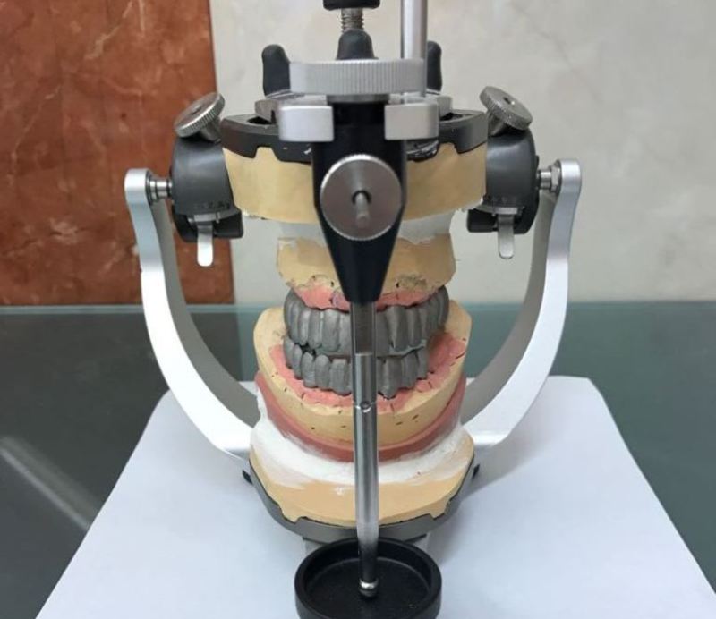 Все зубы по технологии All on six all on six